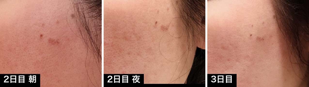 2日目朝・2日目夜・3日目